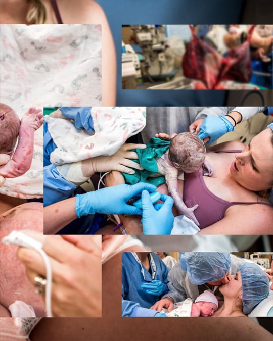 Stunning Photos Capture The Special Moments Of Twins’ Birth