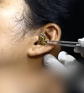 Video: Snake Gets Stuck In Woman's Ear, Leaving Internet Stunned